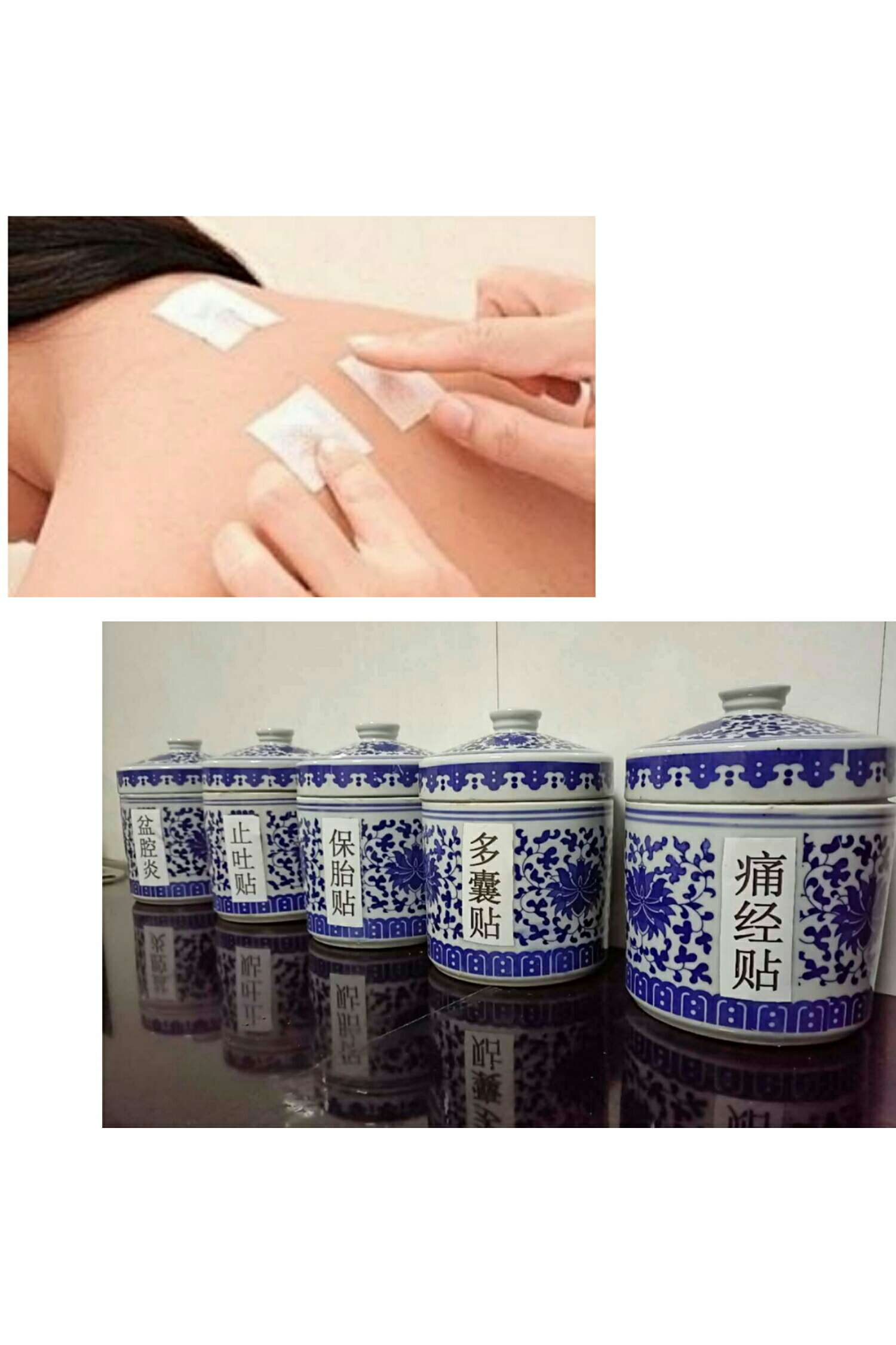 1、三伏貼能治什么病？