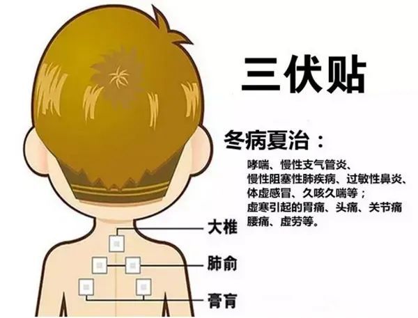 2、三伏貼的功能和功效是什么？