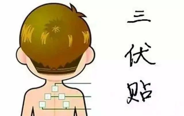 1、“兒童三伏貼”能讓孩子少生病嗎？爸爸媽媽不再盲目跟風(fēng)了。