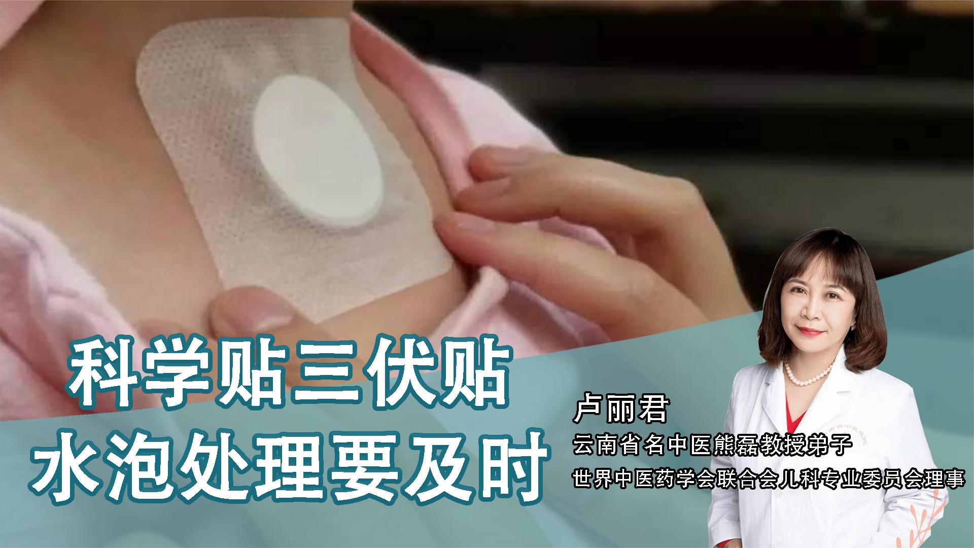 2、貼三伏貼后有什么禁忌？