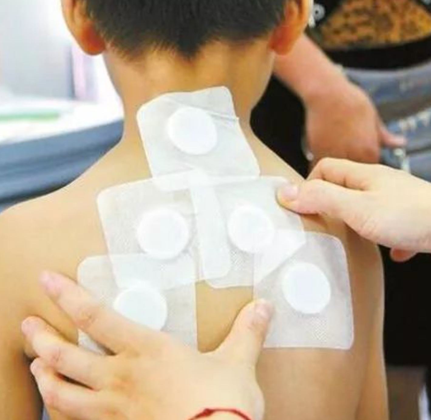 2、三伏貼在脖子上，有一根針，看起來很疼。怎么了